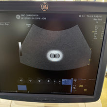 Load image into Gallery viewer, Used GE Logiq E9 Ultrasound with 3Probes L8 18i & 9L & M4S