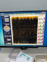 Load image into Gallery viewer, Used Intermed neuronics32 Plus 32Ch EEG Machine