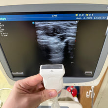 Load image into Gallery viewer, Sale For Used Sonoscape S20 Ultrasound 3 Probes(Convex Linear Vaginal)