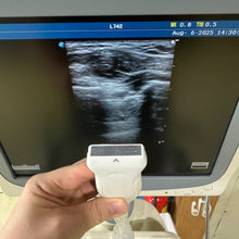 Load image into Gallery viewer, Sale For Used Sonoscape S20 Ultrasound 3 Probes(Convex Linear Vaginal)