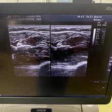 Load image into Gallery viewer, Used GE Logiq E9 XDclear 2.0 Ultrasound With 2 Transducer