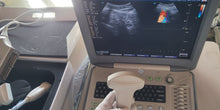 Load image into Gallery viewer, Used Sonoscape S8 Ultrasound Cardiac Convex Linear 3Probes Transducer