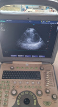 Load image into Gallery viewer, Used Sonoscape S8 Ultrasound Cardiac Convex Linear 3Probes Transducer