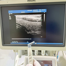 Cargar imagen en el visor de la galería, Used Philips IU22 Ultrasound 3 Probes Set