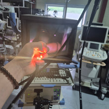 Load image into Gallery viewer, Used Olympus CF-Q150L Colonoscope