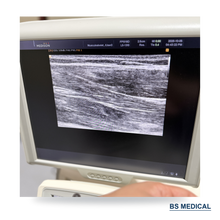 Cargar imagen en el visor de la galería, Used Medison Accuvix V20 Ultrasound with C2-5EL & L5-13IS Probes