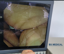 Cargar imagen en el visor de la galería, Venta mundial de procesador de vídeo Olympus CV260 usado para endoscopia