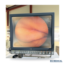 Load image into Gallery viewer, Used Fujinon EC-590WI Colonoscope | Parts Only, Camera Noise & Sheath Defects