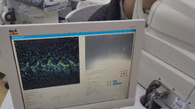Load and play video in Gallery viewer, [World Wide-Selling] Used Zeiss Stratus OCT 3000 Optical Coherence Tomography With Computer Monitor
