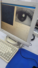Load image into Gallery viewer, [World Wide-Selling] Used Zeiss Stratus OCT 3000 Optical Coherence Tomography With Computer Monitor
