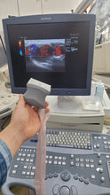 Load image into Gallery viewer, Used Siemens Acuson sequoia 512 acuson 17L5 HD& acuson 6C2 Ultrasound Unit