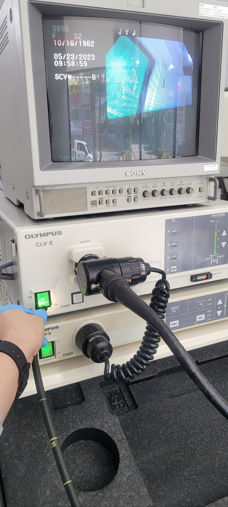Used Olympus CV-E & CLV-E & 9mm Gastroscope GIF-V Endoscopy System