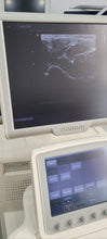 Load image into Gallery viewer, Worldwide Shipped Used Medison Accuvix V20 Ultrasound with Convex Linear Probe
