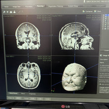 Load image into Gallery viewer, Worldwide Shipped Used Stryker Navigation System Medical Equipment
