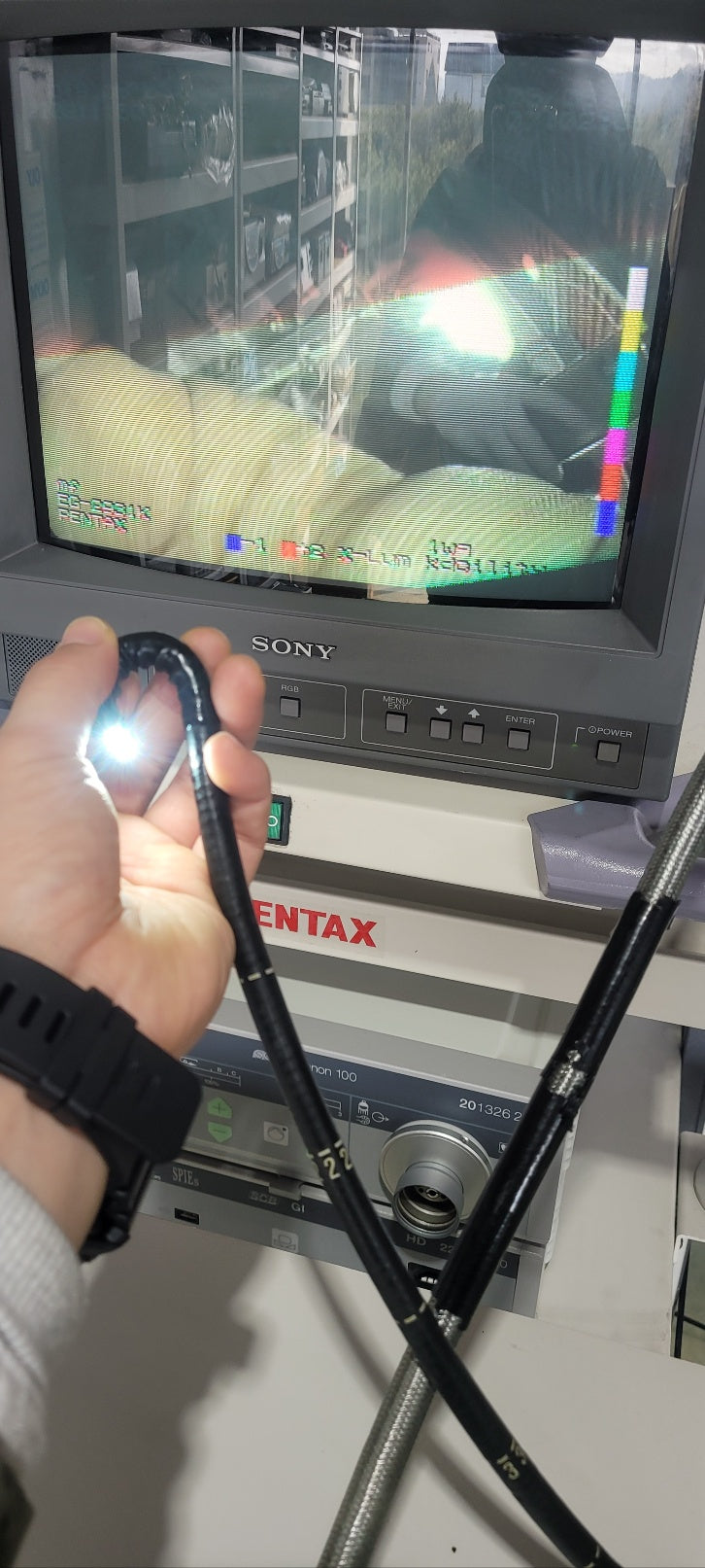 Used Pentax EPK700 Processor with Gastroscope Pentax EG-2931K Endoscopy System