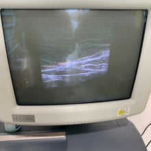 Cargar imagen en el visor de la galería, Worldwide Shipped 2,400$ Used Medison Accuvix XQ 3D Ultrasound With Cardiac Linear Convex 3Probes
