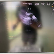 Load image into Gallery viewer, Worldwide Sell Used Medison EKO7 Ultrasound With Cardiac and Convex Probes
