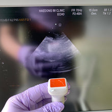 Load image into Gallery viewer, Worldwide Sell Used Medison EKO7 Ultrasound With Cardiac and Convex Probes
