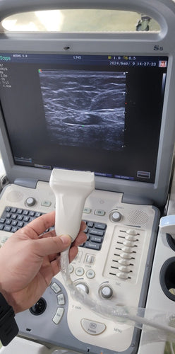 Sell Used sonoscape S8 Ultrasound