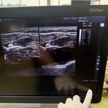 Load image into Gallery viewer, Used GE Logiq E9 XDclear 2.0 Ultrasound With 2 Transducer
