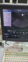 Cargar imagen en el visor de la galería, Used Hitachi Aloka F37 Ultrasound with 3 Probes (Convex, Linear
