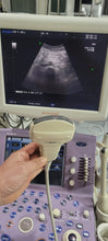 Load image into Gallery viewer, Aloka Alpha 6 Ultrasound with Convex Vaginal
