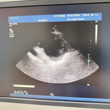 Cargar imagen en el visor de la galería, Used Philips IU22 Ultrasound 3 Probes Set
