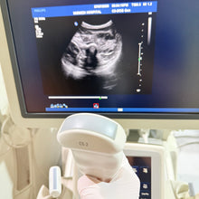Cargar imagen en el visor de la galería, Used Philips IU22 Ultrasound 3 Probes Set
