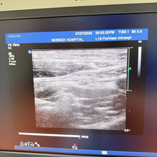 Cargar imagen en el visor de la galería, Used Philips IU22 Ultrasound 3 Probes Set
