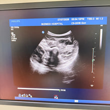 Cargar imagen en el visor de la galería, Used Philips IU22 Ultrasound 3 Probes Set

