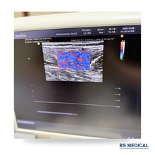 Cargar imagen en el visor de la galería, Used Medison Accuvix V20 Ultrasound with C2-5EL &amp; L5-13IS Probes
