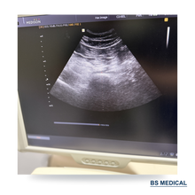 Cargar imagen en el visor de la galería, Used Medison Accuvix V20 Ultrasound with C2-5EL &amp; L5-13IS Probes
