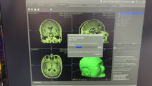 Load and play video in Gallery viewer, Worldwide Shipped Used Stryker Navigation System Medical Equipment
