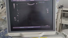 Load and play video in Gallery viewer, Worldwide Selling on (T-2) Used Toshiba PVT-661VT Vaginal Probe Transducer For Aplio 400 Xario
