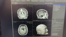 Load and play video in Gallery viewer, Worldwide Shipped Used Stryker Navigation System Medical Equipment
