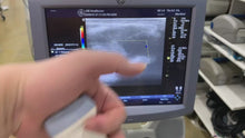 Load and play video in Gallery viewer, Worldwide Shipping Used GE Logiq P5 Ultrasound Unit with Linear Probe Convex Probe Medical Equipment
