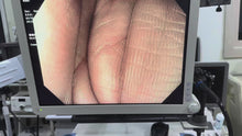 Load and play video in Gallery viewer, Sale For Olympus GIF H170 Gastroscope
