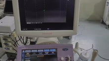 Load and play video in Gallery viewer, Aloka Alpha 6 Ultrasound with Convex Vaginal
