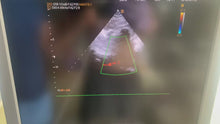 Load and play video in Gallery viewer, Worldwide Sell Used Medison EKO7 Ultrasound With Cardiac and Convex Probes
