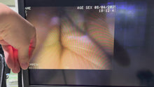 Load and play video in Gallery viewer, 2025 N9 Pentax EPK1000 with EG 2770K Gastroscope Sysetm
