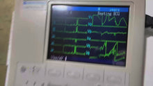 Load and play video in Gallery viewer, Worldwide Sell 650$ Used Nihon Kohden Cardiofax S EKG ECG
