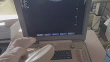 Load and play video in Gallery viewer, Used Sonoscape S8 Ultrasound Cardiac Convex Linear 3Probes Transducer

