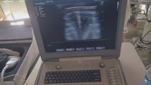 Load and play video in Gallery viewer, Used Sonoscape S8 Ultrasound Cardiac Convex Linear 3Probes Transducer
