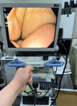 Load image into Gallery viewer, Sale For Olympus Endoscopy Video Processor CV170
