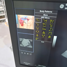 Load image into Gallery viewer, Used GE Versana Balance ultrasound – photo 3
