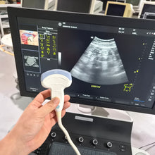 Load image into Gallery viewer, Used GE Versana Balance ultrasound – photo 4

