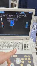 Load image into Gallery viewer, WorldWide Selling on Used Siemens Acuson P300 Portable Ultrasound with Siemens LA523 Linear Probe&amp;Siemens CA431 Convex Probe
