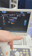 Load image into Gallery viewer, WorldWide Selling on Used Siemens Acuson P300 Portable Ultrasound with Siemens LA523 Linear Probe&amp;Siemens CA431 Convex Probe
