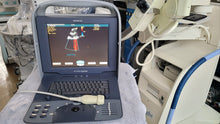 Load image into Gallery viewer, Worldwide Selling on Used Siemens Acuson Cypress With Cardiac 3V2c Probe Portable Ultrasound
